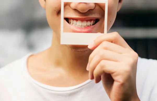 A person holding a small photograph of a perfect white smile over their mouth