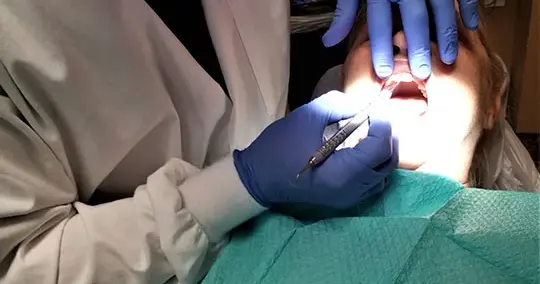 Fixing A Broken Tooth
