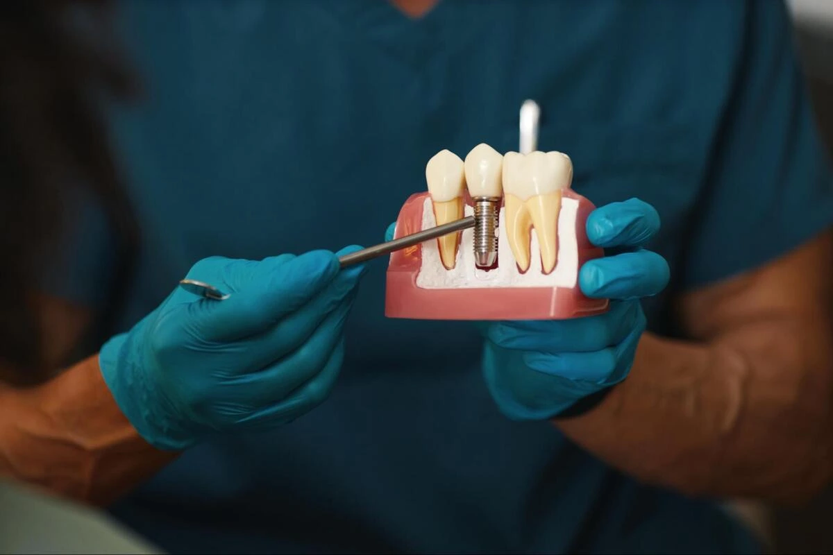 Dentist wearing blue gloves holding a dental jaw model and pointing to a tooth with a dental instrument during a patient explanation