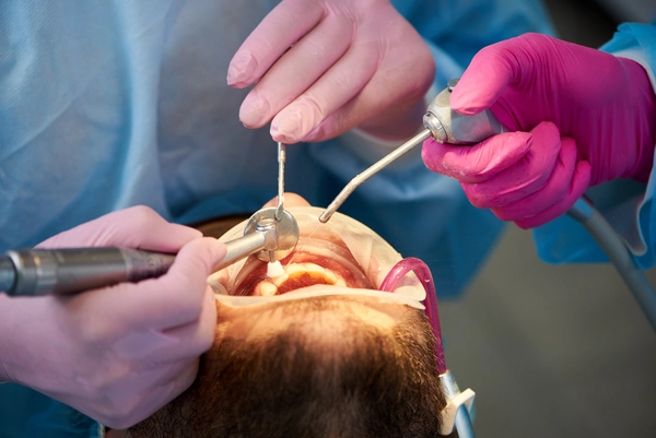 Close-up of a dentist performing a restorative scaling and polishing procedure on a patient.