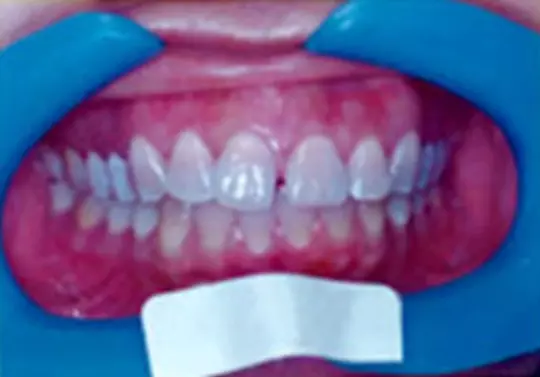 Expert Orthodontics near Clementi: Transform Your Smile Today