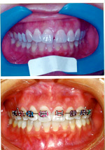 Orthodontics Images